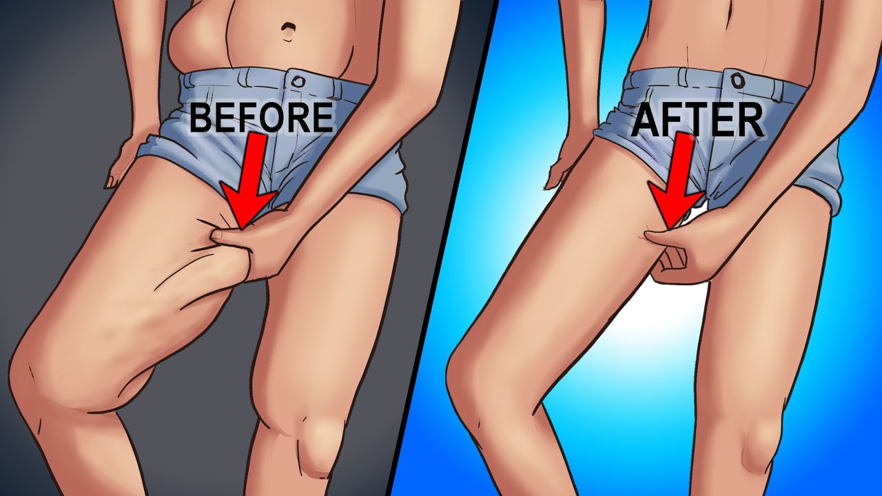 3 Steps to Lose Thigh Fat FAST
