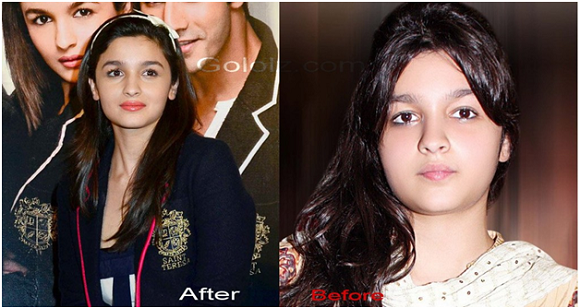 Alia Bhatt's Weight Loss before and after