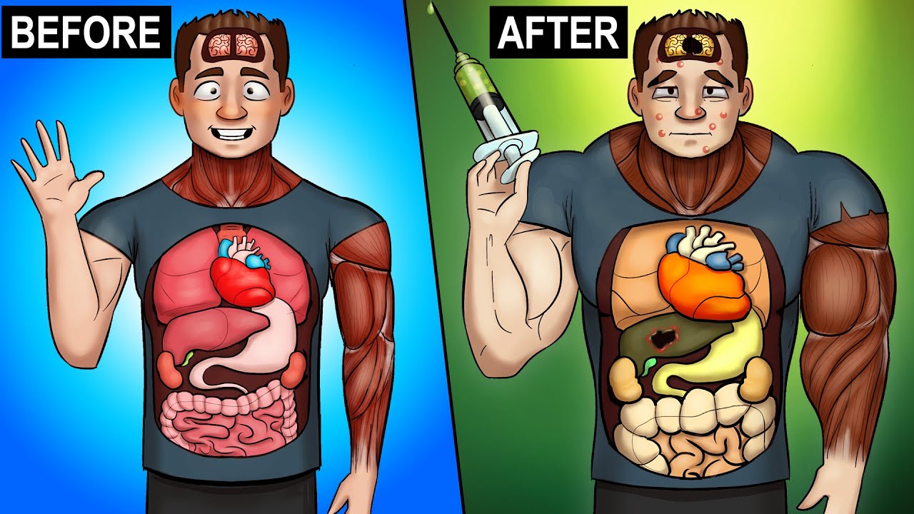 what-happens-to-your-body-on-steroids